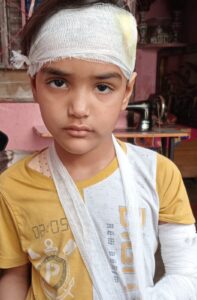 ई-रिक्शा की टक्कर से बच्ची गंभीर रूप से घायल